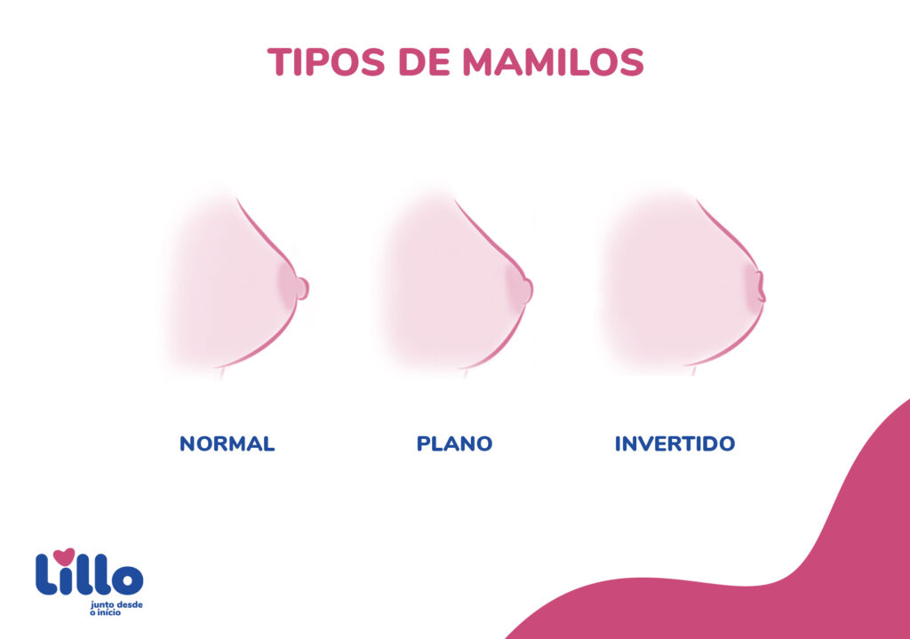 Comparação entre tipos de mamilos